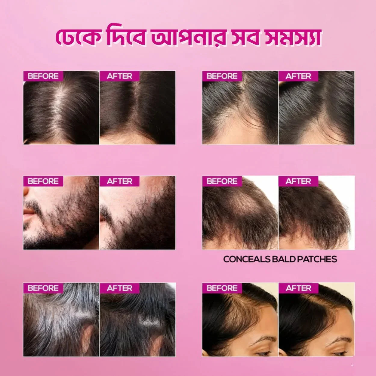 Shokhi Beauty "Cover Up" Hair Powder - Shokhi Beauty