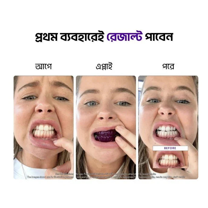 Teeth Whitening Strips - Shokhi Beauty