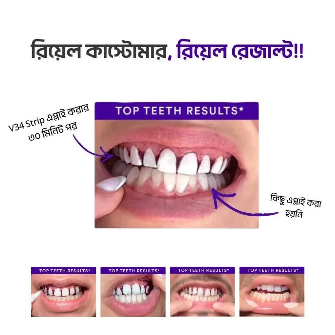 Teeth Whitening Strips - Shokhi Beauty