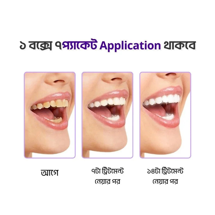 Teeth Whitening Strips - Shokhi Beauty